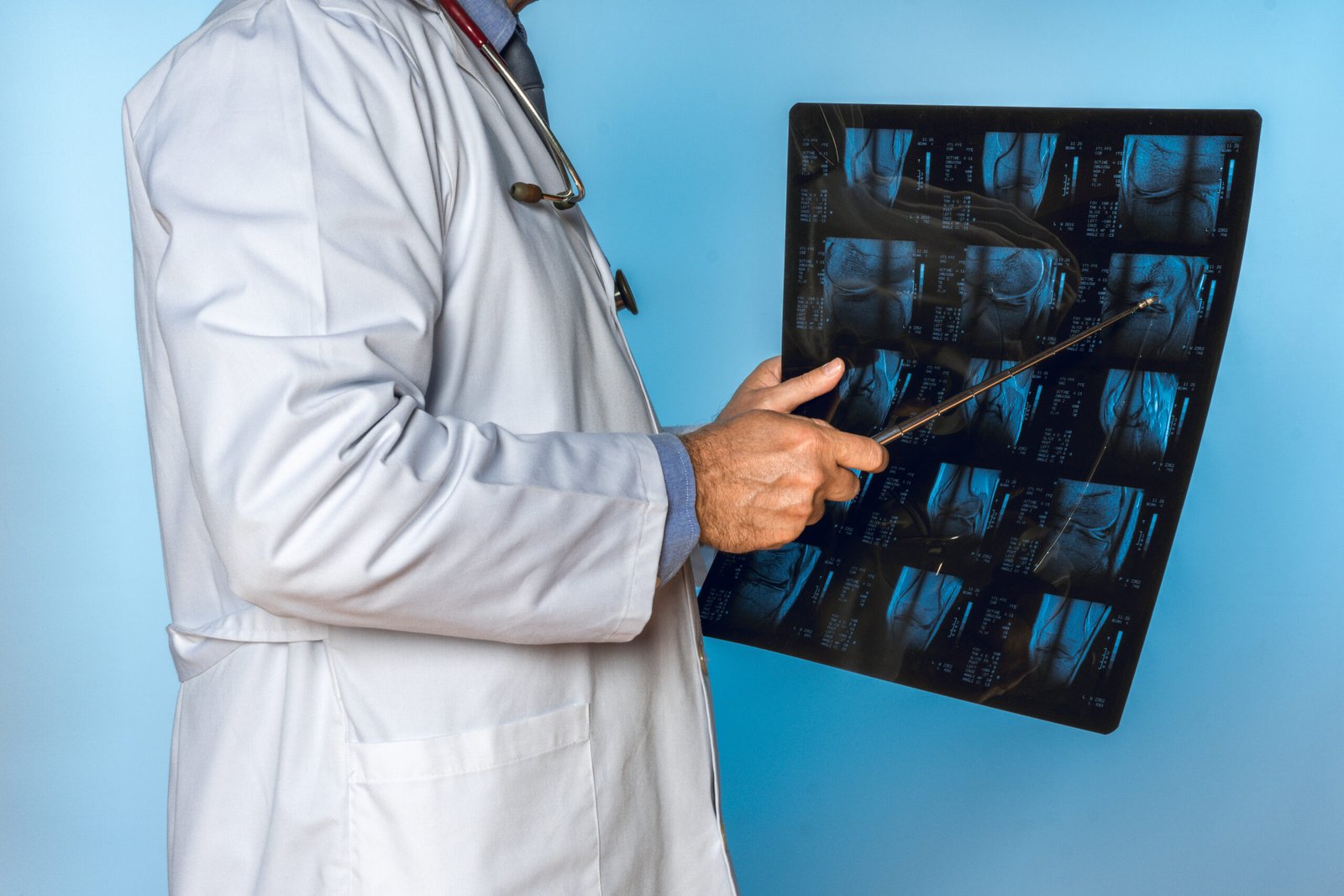 Doctor señalando tomografía con varilla de acero